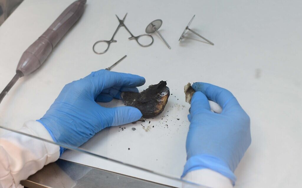 A charred bone shard from an unidentified victim of the mass murderous attack by Hamas on southern Israeli communities on October 7, 2023 is examined at the National Center of Forensic Medicine (Abu Kabir) in Jaffa, October 16, 2023. (Tomer Neuberg/Flash90)