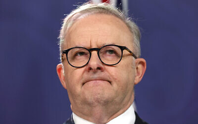 Australia's Prime Minister Anthony Albanese reacts during a press conference in Sydney on December 20, 2023. (David Gray/AFP)