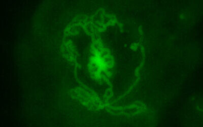 A fluorescent image of a testicular organoid created from mouse embryos and incubated in a dish for 14 days in Dr. Nitzan Gonen's lab at Bar-Ilan University.  (Cheli Lev
