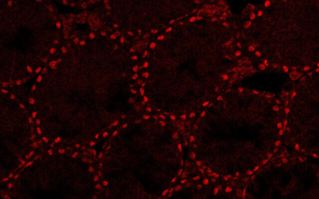 Image of real testes of 28-day-old mice created in Dr. Nitzan Gonen's lab at Bar-Ilan University (Aviya Stopel)