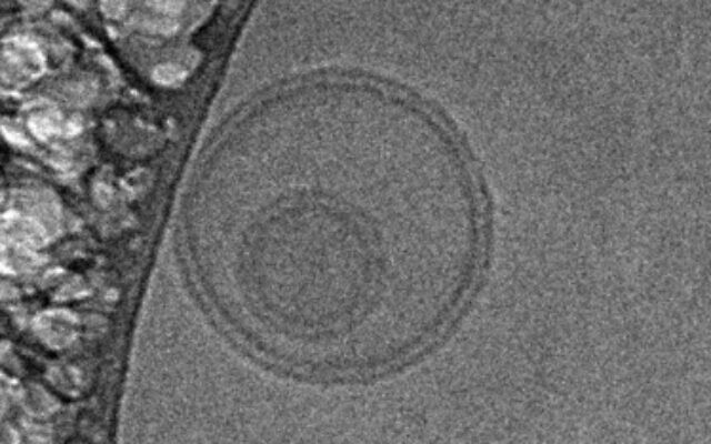 Image of two small extracellular vesicles (sEVs), one on top of the other, captured using cryogenic electron microscopy. The double-layer membrane, a hallmark of sEVs, is clearly visible. (Leor's lab, Neufeld and Tamman Cardiovascular Research Institutes, School of Medicine, Tel Aviv University and Lev Leviev Cardiovascular and Thoracic Center, Sheba Medical Center)