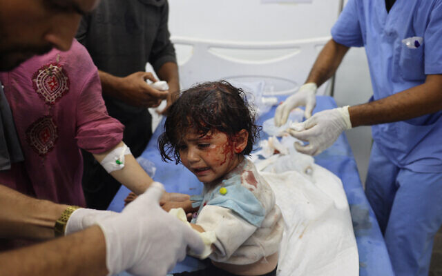 A Palestinian girl - wounded after an Israeli airstrike on what the IDF said was a Hamas compound, adjacent to a camp for internally displaced people in Rafah, late on May 26, 2024 - receives treatment at a hospital in Rafah (Eyad BABA / AFP)
